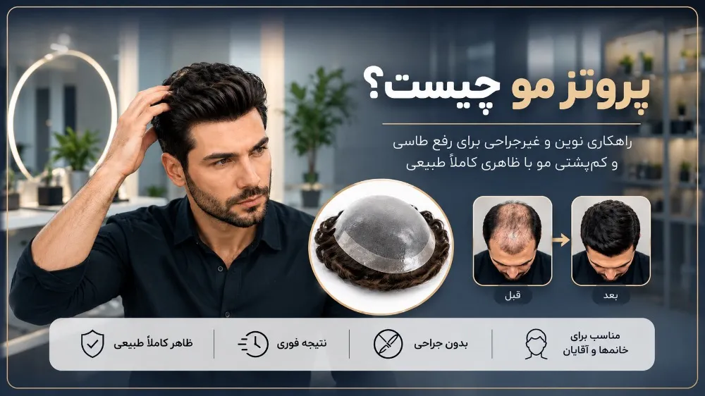 انواع پروتز مو؛