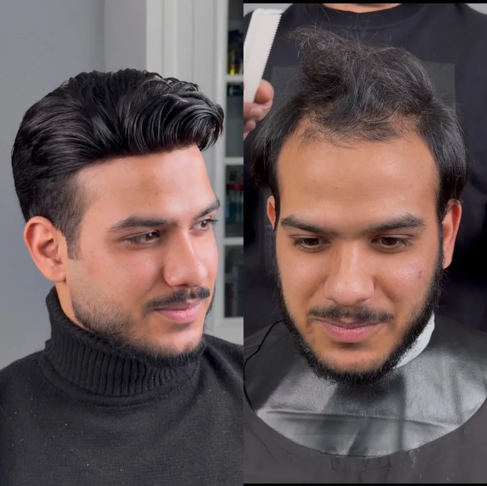 قبل و بعد