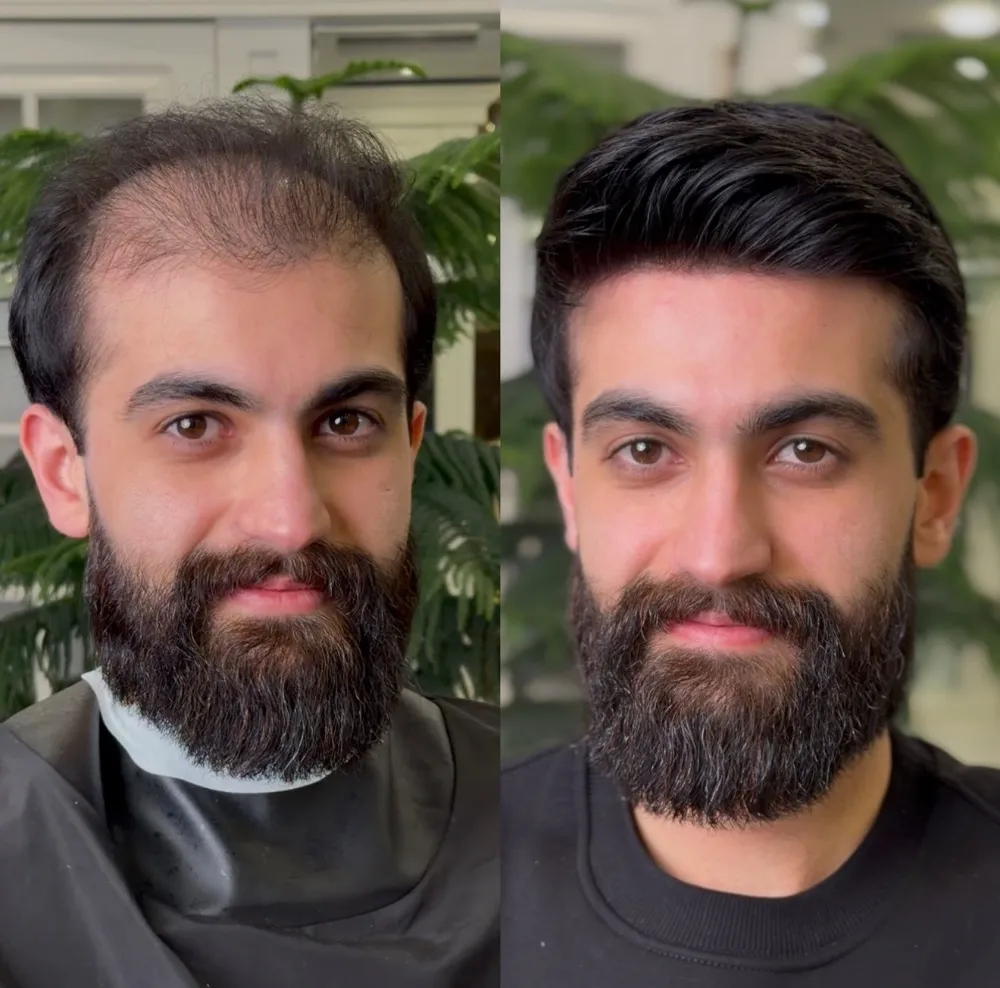 قبل و بعد